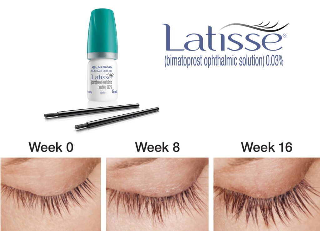 LATISSE® (bimatoprost ophthalmic solution) 0.03%