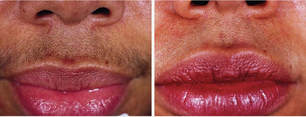 Lip