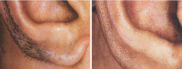 Ear